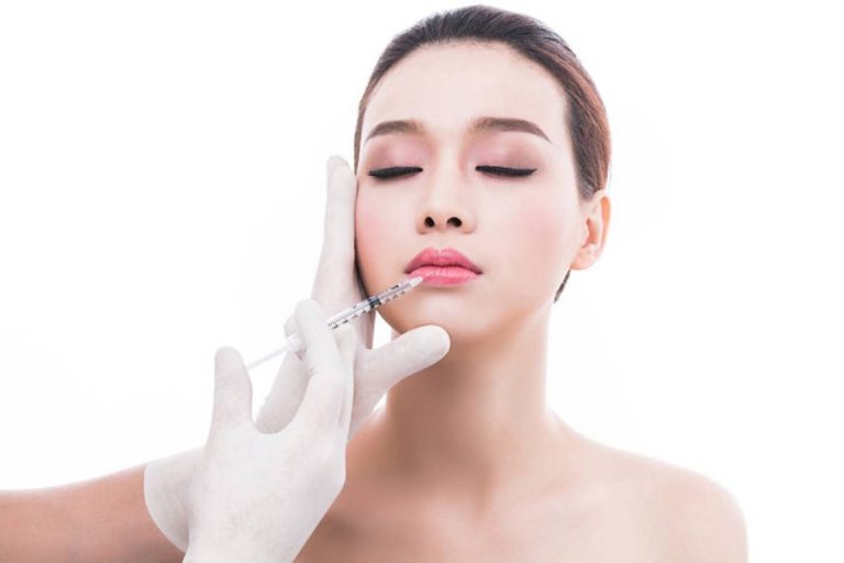 Tiêm Filler Môi: Những Điều Cần Biết Trước Khi Quyết Định